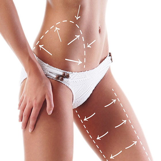 Body Sculpting Skin Firming Best Body Treatments Mayfair Practice